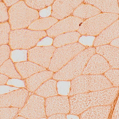 Immunohistochemistry image of a mouse quadriceps labeled with DSHB antibody 10F5 against Myosin heavy chain, Type IIB. PMID: 37511653, Fig. 6.